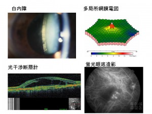 眼科学講座