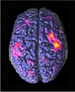 脳磁場計測による聴覚野の解析