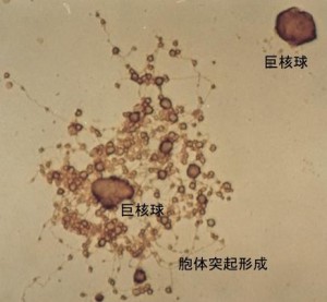血液内科