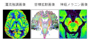 超高磁場